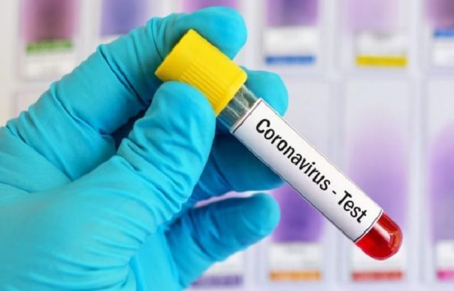 Togo, Coronavirus : Trop de laxisme…