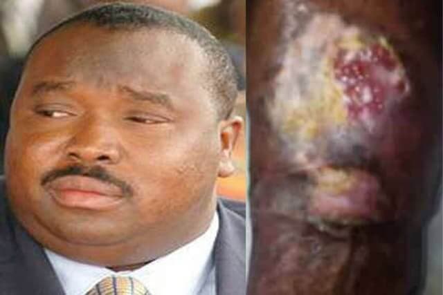 Togo-Huit mois d’hospitalisation : L’impossible évacuation pour Kpatcha Gnassingbé