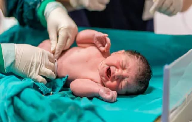 Un enfant est né… avec une queue de 12 centimètres