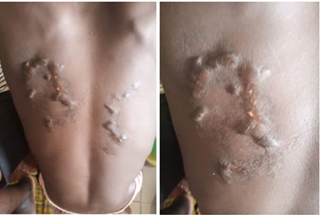 Togo-Affaire « Tigre Révolution » : Le détenu Ouro-Medji I Sadikou sauvagement torturé