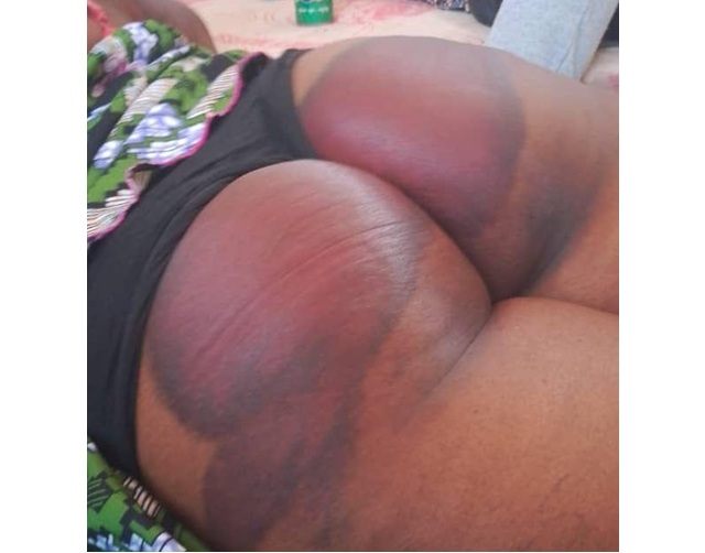 Togo : Un rapport international dénonce des violences policières et des violations des droits humains lors des manifestations des 5 et 6 juin