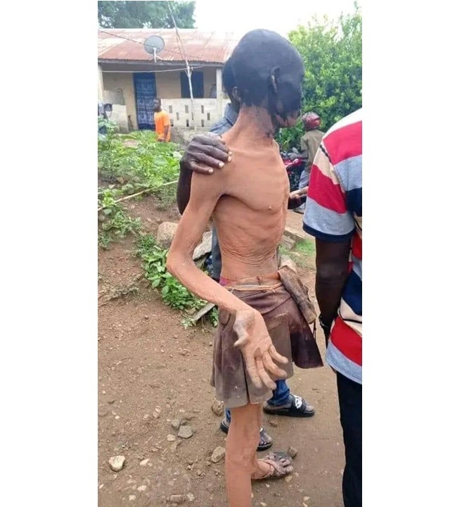 Togo/Evala 2025 : un jeune homme interpelle Faure Gnassingbé avec un geste de la faim (vidéo)