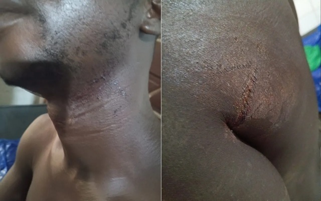 Togo/ Lassa : un responsable local de Togo Espoir grièvement blessé à la machette